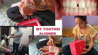 My Toothsi Aligner: Day 1|Unboxing of Toothsi Aligner|Braces Precaution in India|Toothsi