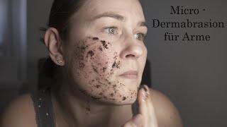 Micro Dermabrasion für Arme - Wir holen das Beauty Spa nach Hause!