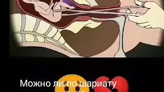 Яке аз тифл безор аст  яке дар нохунаш зор аст