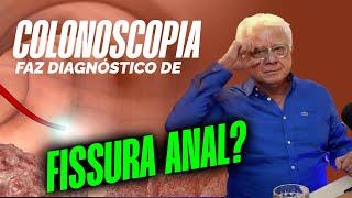 A colonoscopia diagnostica a fissura anal? Com Dr. Paulo Branco Proctologista