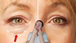 Reduce UNDER EYE BAGS and dark circles naturally