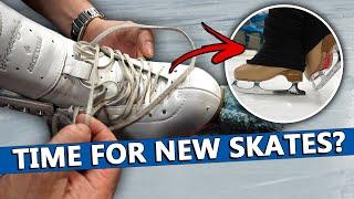 How To Tell If You Need New Figure Skates?