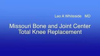 Missouri Bone and Joint Center Total Knee Replacement Leo Whiteside