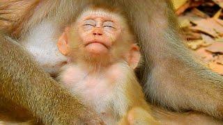 OMG! What happen and problem on the eyes of baby monkey Lily