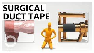 Surgical Duct Tape: Animated Explainer