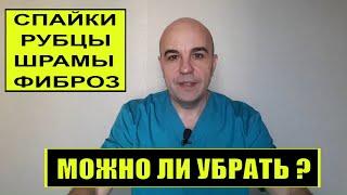 Спайки рубцы шрамы фиброз Почему вредно и как устранить вред для здоровья