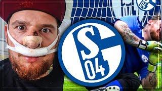 Fussball CHALLENGE gegen SCHALKE PROFI endet in KRANKENHAUS OP 