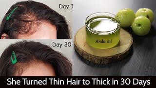My Mom Turned her Thin Hair to Thick Hair in 30 Days - Amla Hair Oil for Hair Growth & Long Hair