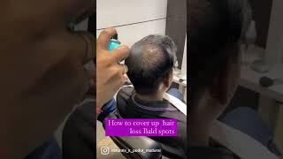 How to cover up hair loss bald spots 