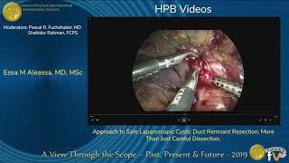 Approach to Safe Laparoscopic Cystic Duct Remnant Resection: More Than Just Careful Dissection