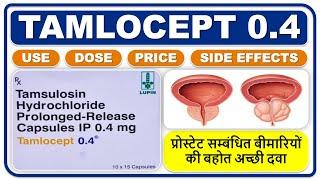 प्रोस्टेट सम्बंधित बीमारियों की बहोत अच्छी दवा, टैमलोसेप्ट 0.4 कैप्सूल संपूर्ण जानकारी हिंदी में