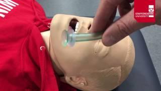 Nasopharyngeal Airway Insertion