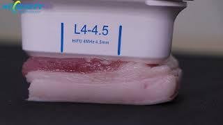 Testing on pork by hifu shot (HCBEAUTY 7d HIFU)