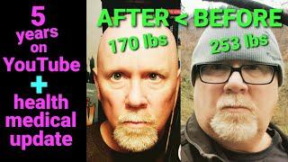 Lost 83 lbs. Almost Died. 5 Years On YouTube. Medical/Health Woes & A Huge "Thank You" To Everyone.