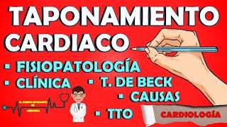 TAPONAMIENTO CARDIACO Semiología,Fisiopatología,Causas,Triada,ECO,Ecg,Tratamiento,Pericardiocentesis