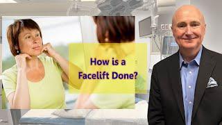 How is a Facelift Done?