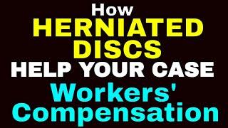 A Herniated Disc Diagnosis Makes a Workers' Compensation Case Stronger