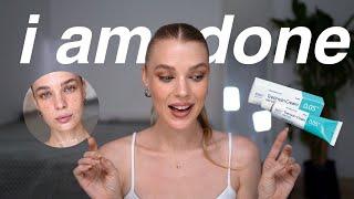 i quit tretinoin after 16 months ◽️ here are my reasons and the new plan