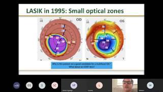 Webinar Advances in Topography, Keratoconus and Crosslinking