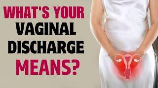 Vaginal Health: Know what the colour of your vaginal discharge says!