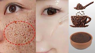 How to get rid of large pores in 3 days / Discover the secret of glass skin