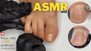 ASMR pedicure | asmr nail | cleaning pedicure asmr