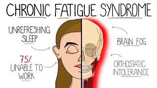 Myalgic Encephalomyelitis (Chronic Fatigue Syndrome) | Includes Criteria & Treatment