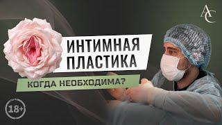 Интимная пластика (лабиопластика). Когда необходима?