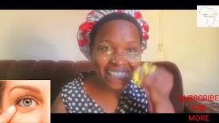 How to remove the eye bags in a local way//African lifestyle#herbal #africa