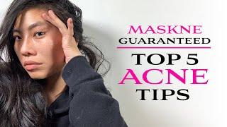 ACNE // How to get rid of acne // This is what you’re doing wrong // Tips and Tricks // Green beauty