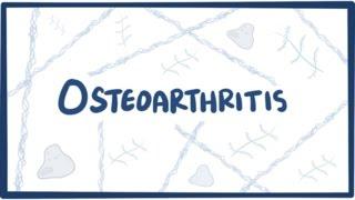 Osteoarthritis - causes, symptoms, diagnosis, treatment & pathology