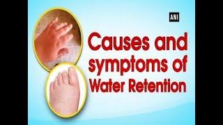 Causes and symptoms of Water Retention - ANI News