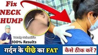 Neck Hump Exercises in Hindi | How to remove fatty Neck Hump | Dowager's hump, Buffalo hump Exercise