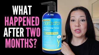 HAIR LOSS SUFFERER TESTS PURA D'OR ANTI THINNING THERAPY SHAMPOO 8 WEEK REVIEW WITH BEFORE AND AFTER