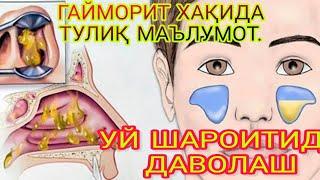 ГАЙМОРИТ БУ НИМА?  УЙ ШАРОИТИДА ДАВОЛАШ ЮЛЛАРИ. GAYMORIT BU NIMA?