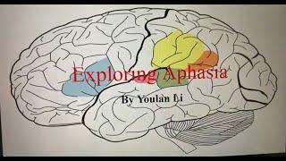 Exploring Aphasia: Understanding Language Challenges and Empowering Communication