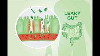 5 Causes of A Leaky Gut And The Symptoms it Causes