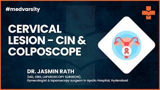 Case Discussion on Cervical Lesion - CIN & Colposcope | @MedvarsityOnlineLtd