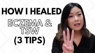 How I Healed Eczema and TSW Naturally (3 THINGS THAT HELPED)