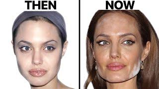 Angelina Jolie NEW FACE | Plastic Surgery Analysis