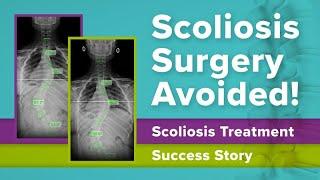 Scoliosis Surgery Avoided! Scoliosis Treatment Success Story