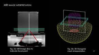 Breuer - Validation of Raytracer Approach for Modeling Temp. Distribution Under HIFU (Poster) (2020)