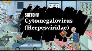 Understanding Cytomegalovirus:Herpes Virus Family Study (Full Lesson)| Sketchy Medical |USMLE Step 1