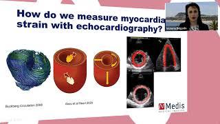 Dr. Victoria Delgado on the use of ECHO in Strain research - EACVI