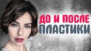 ЗВЕЗДЫ ШОУ БИЗНЕСА ДО И ПОСЛЕ ПЛАСТИКИ