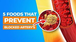 5 MUST Eat foods to Prevent Blocked Artery's and Heart Attacks