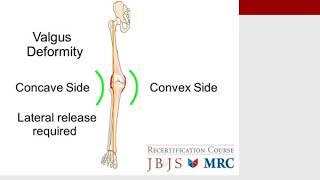 MILLER'S 2016 Orthopaedics:  Adult Knee Reconstruction