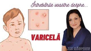 VARICELA la COPII (Vărsat de vânt): simptome, tratament, izolare