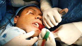 Maxillofacial Complete Facemakeover surgery - Plastic Surgery in India