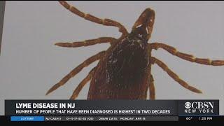 Expert Warns About Lyme Disease And New Jersey's Uptick In Ticks